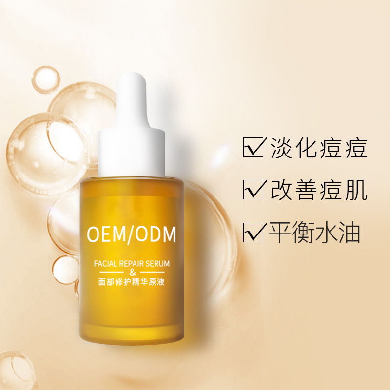 毕节市_祛痘精华原液OEM
